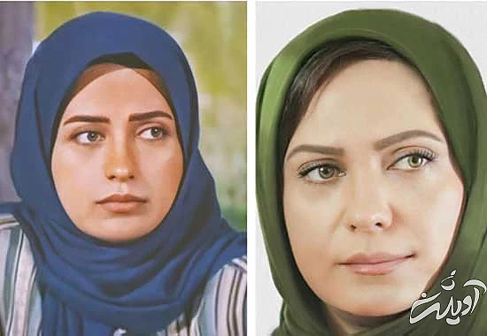 جراحی افتادگی پلک؛